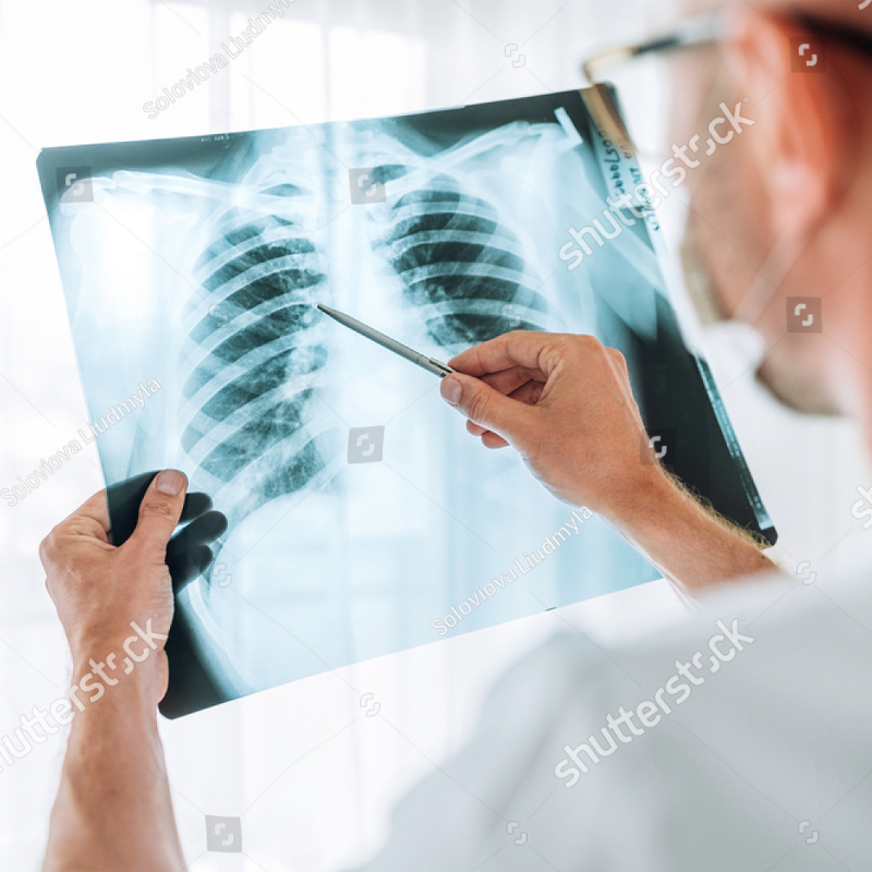Рентгенографиядетям